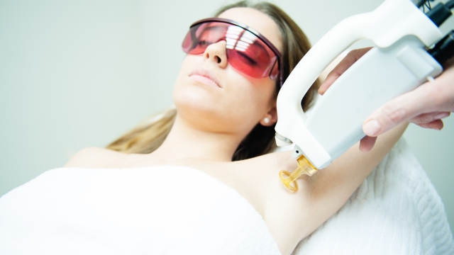 Flawless & Fuzz-Free: The Ultimate Guide to Laser Hair Removal