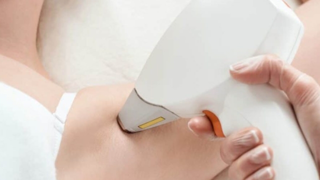 Say Goodbye to Unwanted Hair! A Guide to Laser Hair Removal